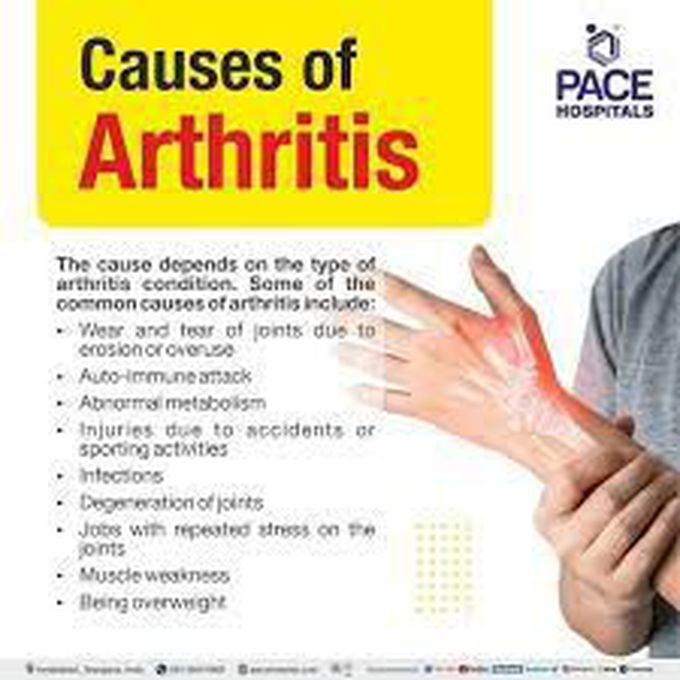 What is the main cause of arthritis? - MEDizzy