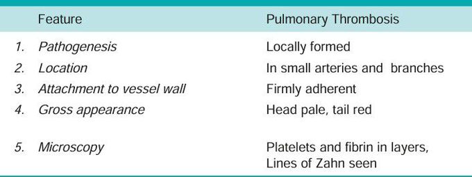 Pulmonary embolism