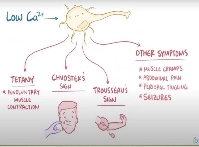 Hypoparathyroidism