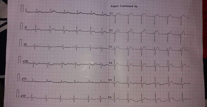 Diagnosis Please...