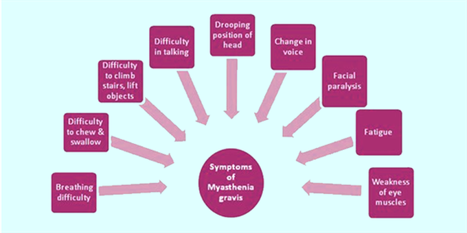 Symptoms of Myasthenia gravis