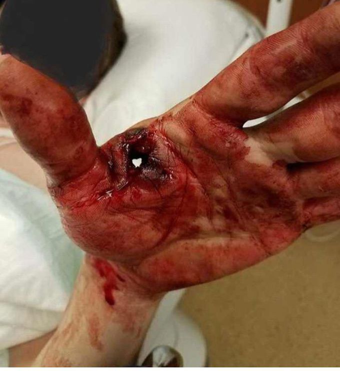 Cleaning a gun gone wrong