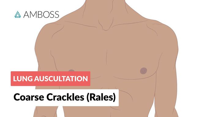 Coarse Crackles (Rales) - Lung Auscultation