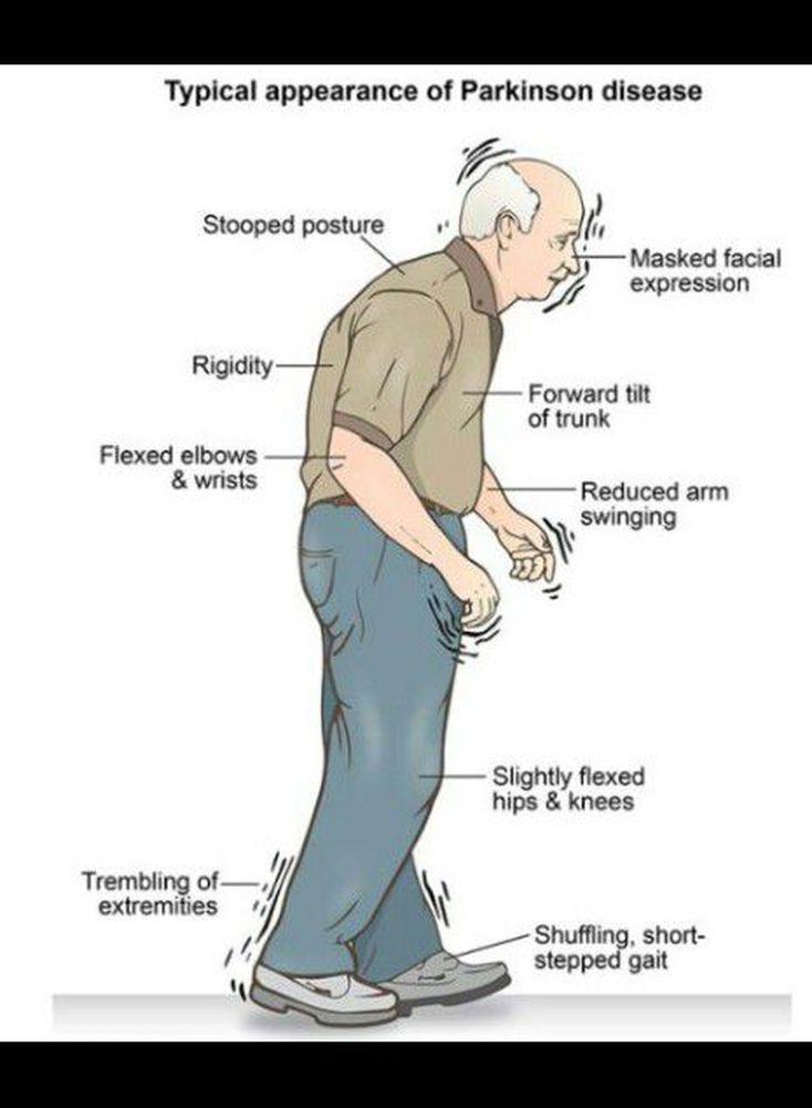 Parkinsonism - MEDizzy