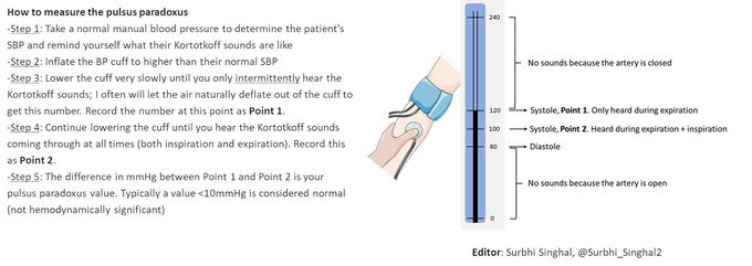 How to measure pulsus paradoxus