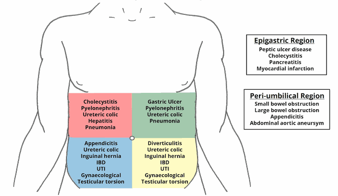 Acute abdomen