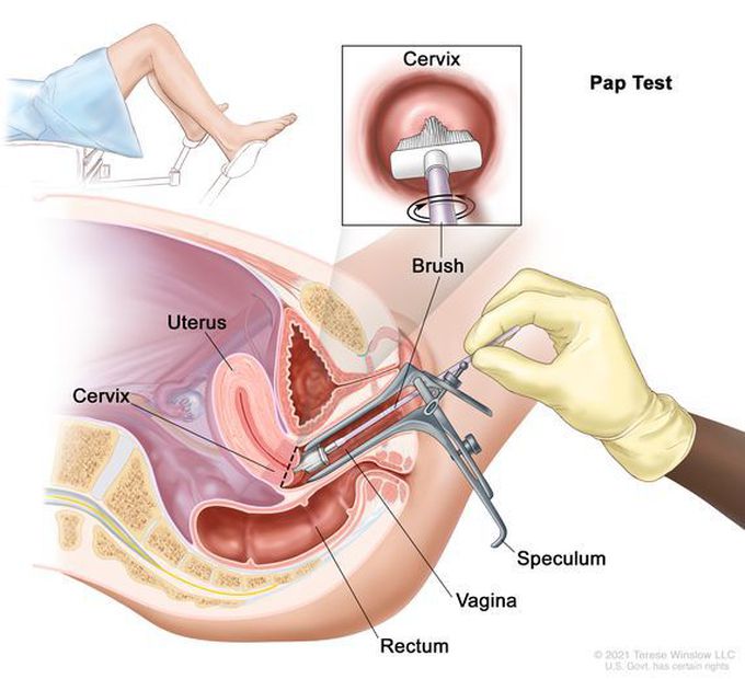 Indications of Pap Smear