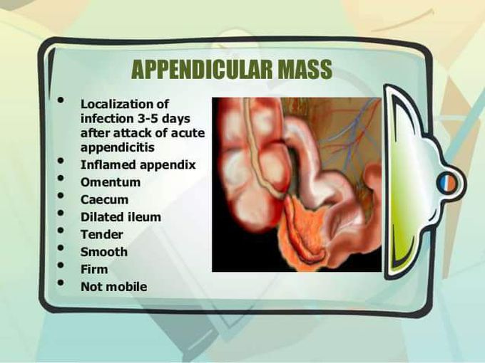 Appendix