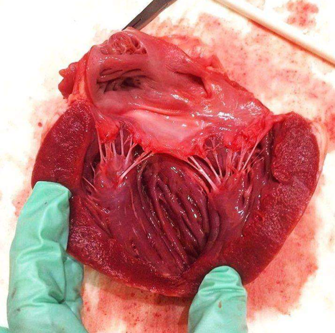 Heart ♥