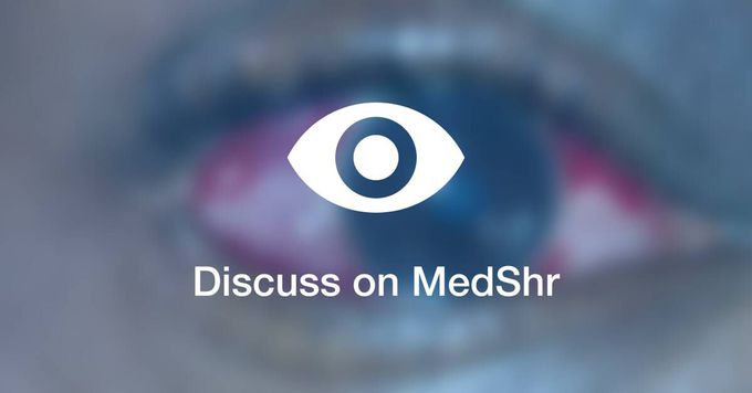 What is the diagnosis of this ocular condition ,causes ,sign and symptoms, treatment