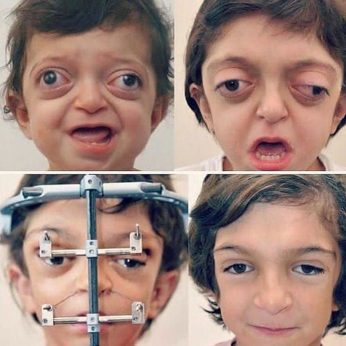 Medical reconstructive surgery at its finest!