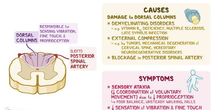 These are the symptoms of Posterior cord syndrome