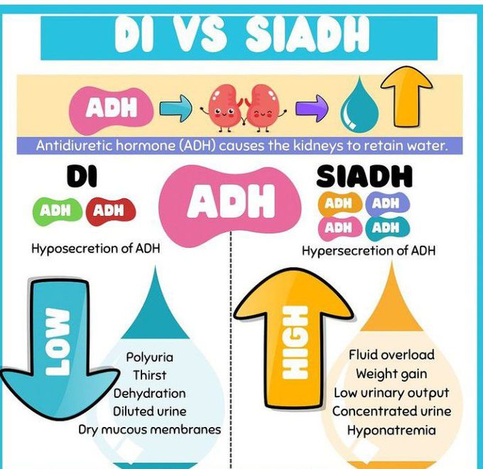 DI vs SIADH