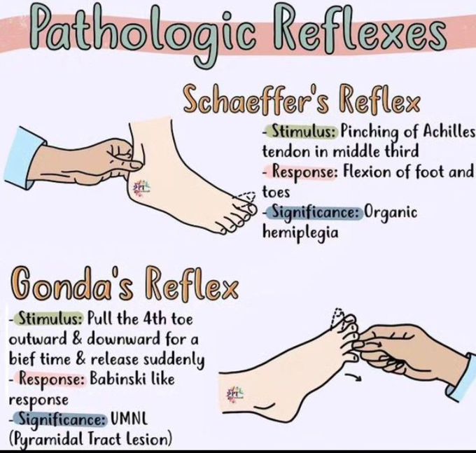 Pathological Reflexes