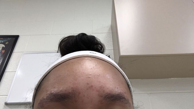 Eyebrow scare