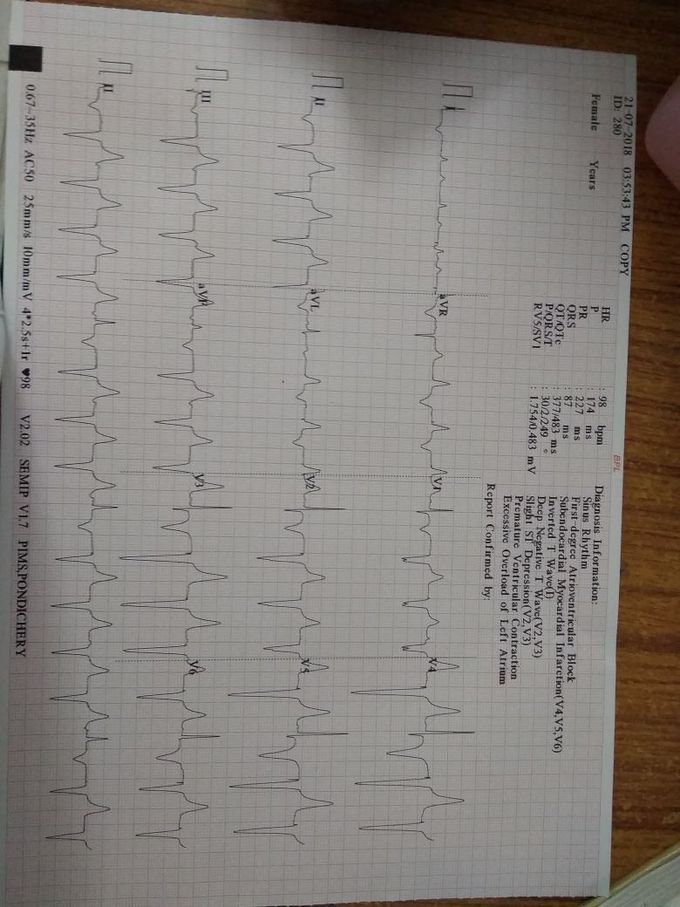 Ur diagnosis