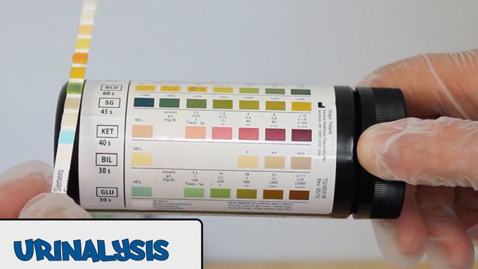 Urinalysis