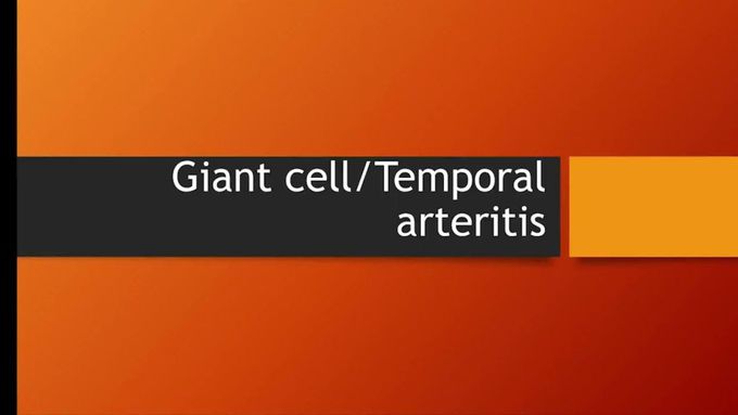 Flashcard- Giant cell arteritis
