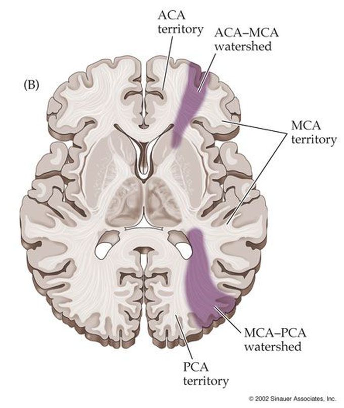 Watershed areas of brain