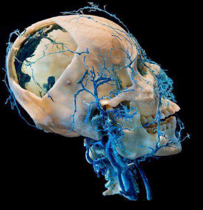 Facial plastination.
