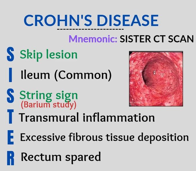 Crohn's Disease Mnemonic I