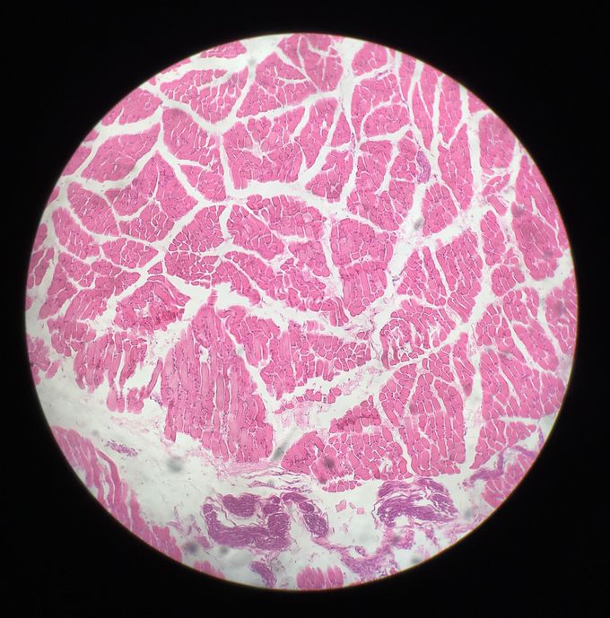 A transverse section of the skeletal muscle.