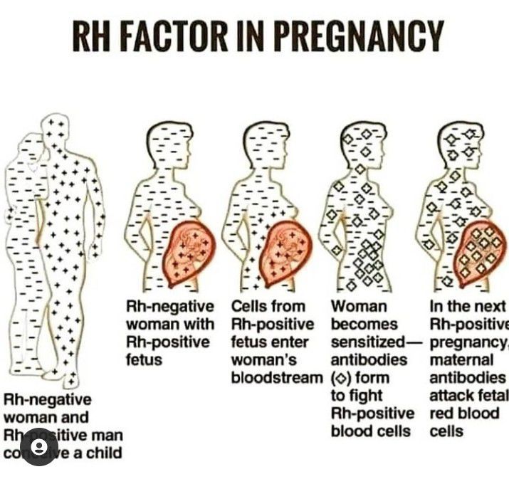 What Does Rh Factor Positive Mean During Pregnancy