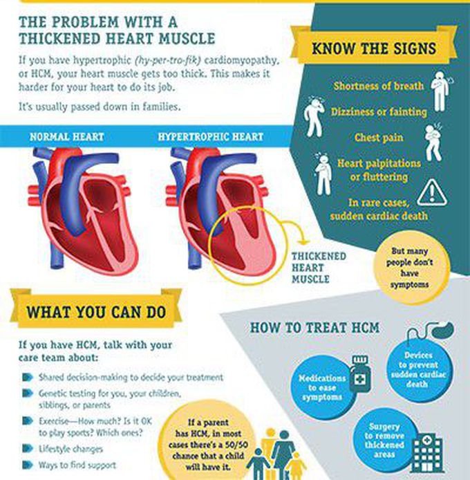 Cause of Hypertrophic Cardiomyopathy