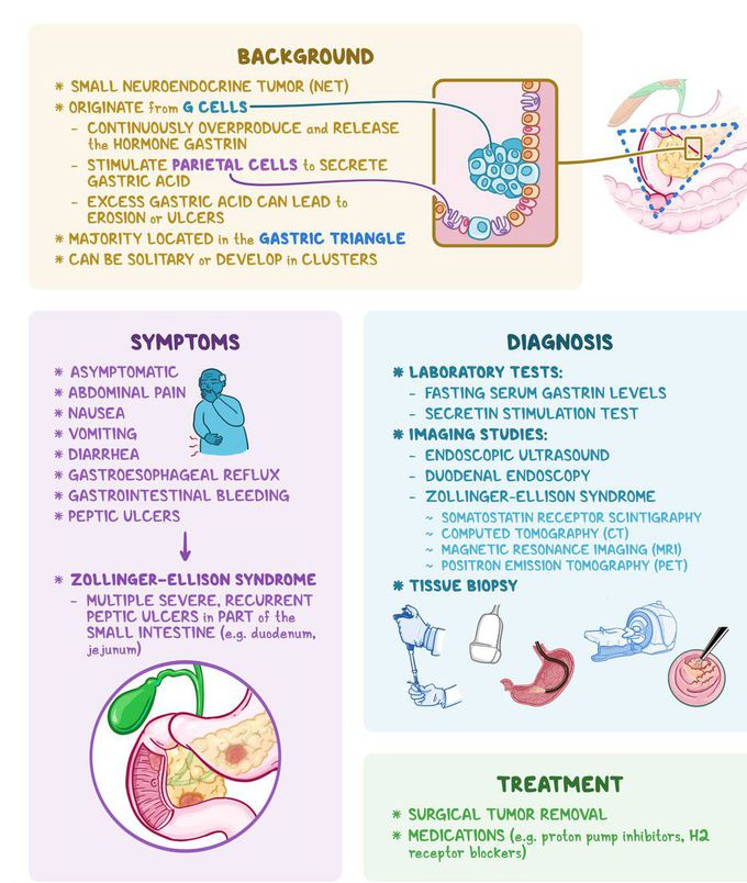 Symptoms of Zollinger-Ellison syndrome