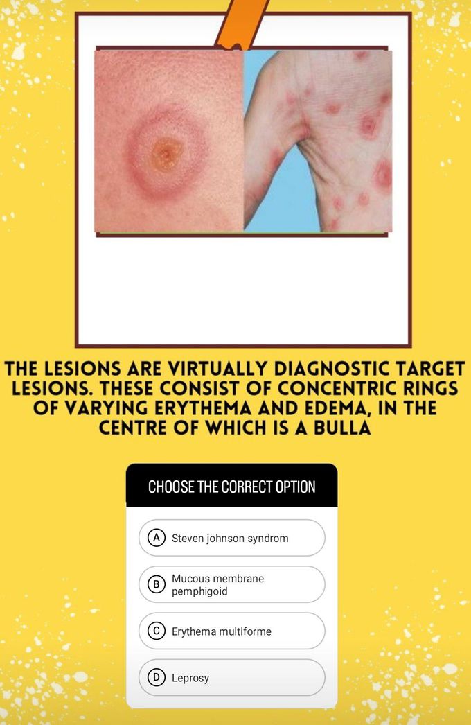 Identify the Lesion II