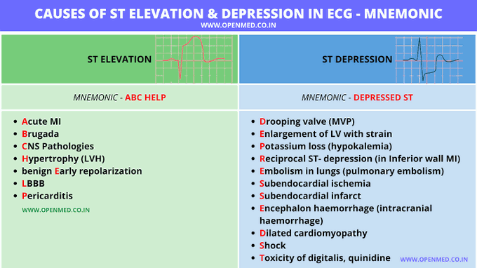 Causes of St Elevation and Depression in ECG
