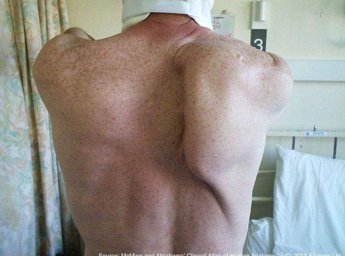 Scapula and Clavicle - Shoulder Girdle - Anatomy Tutorial 