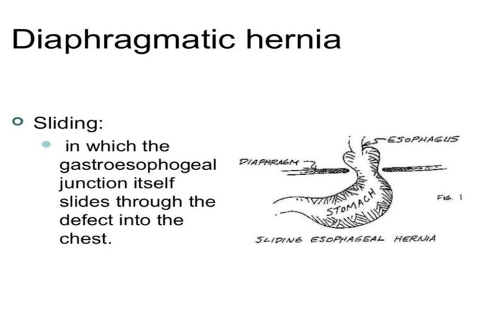 Diaphragmatic Hernia- I