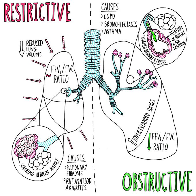 Define Obstructive Restrictive Lung Disease