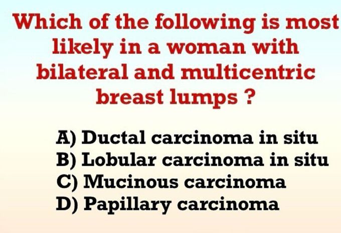 Multicentric Breast Lump