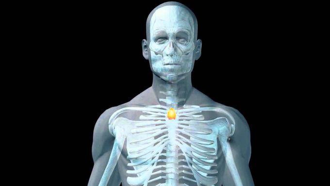 Diagnosis of Myasthenia Gravis.