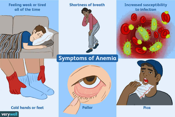 Symptoms of anemia