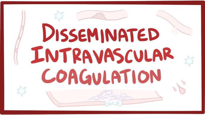Disseminated intravascular coagulation - causes, symptoms, diagnosis, treatment, pathology