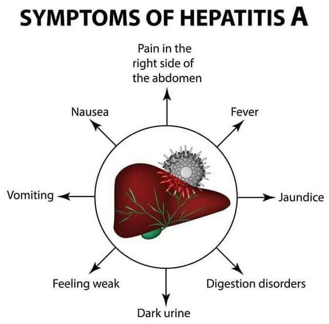 Hepatitis