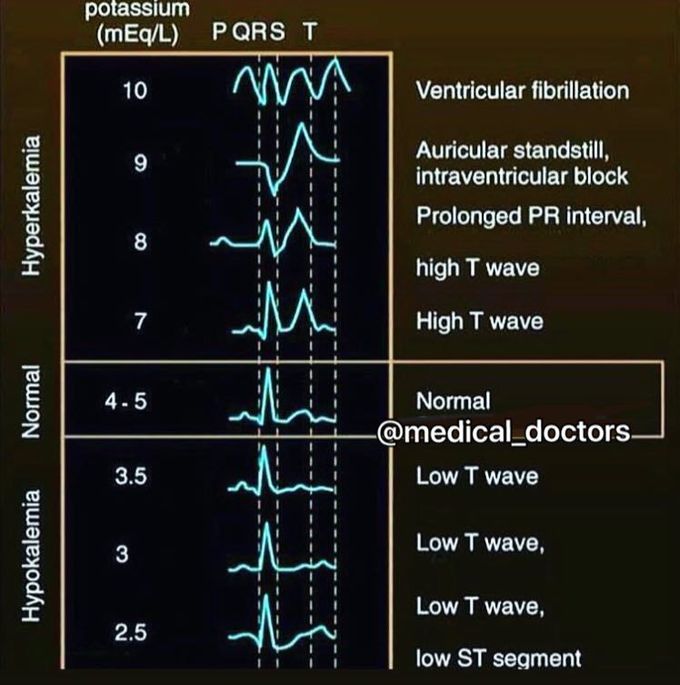 Ecg view - MEDizzy