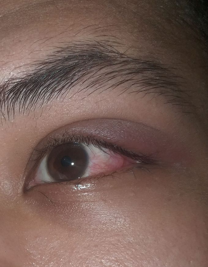 Ophthalmology