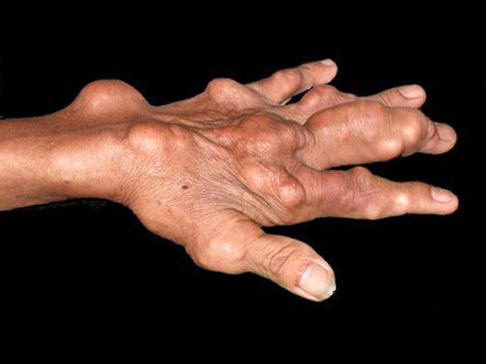 What will your diagnosis ??