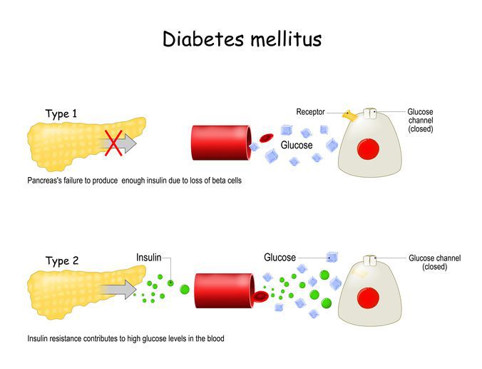 Diabetes - MEDizzy