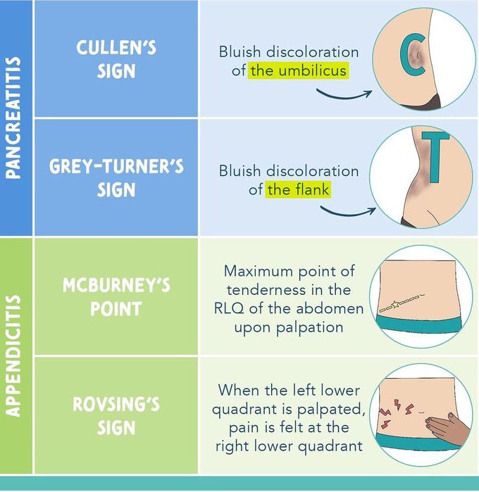 Pancreatitis vs appendicitis medizzy