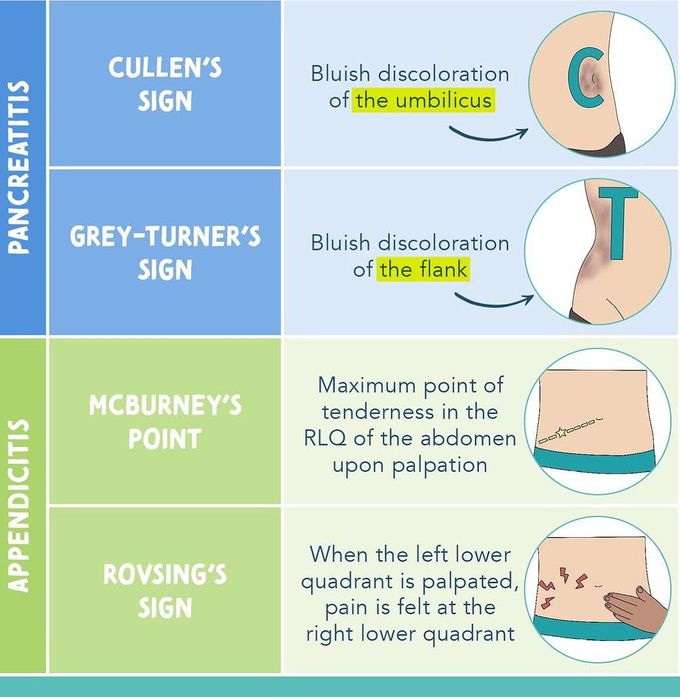 Pancreatitis Vs Appendicitis