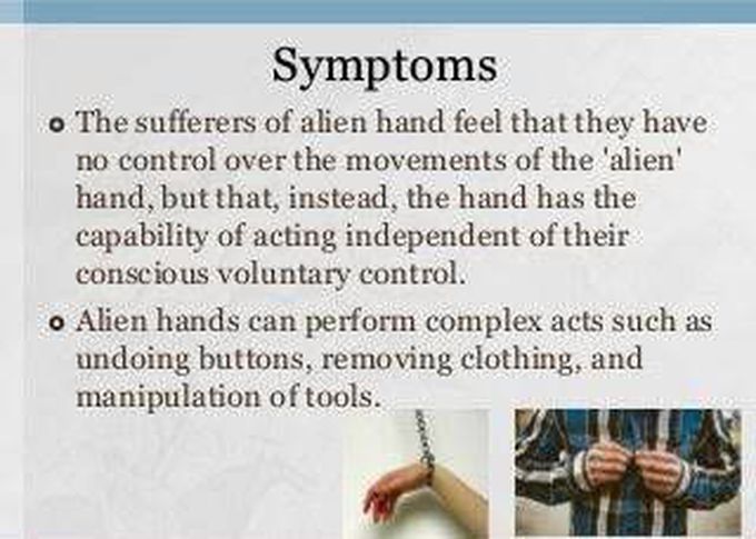 These are the symptoms of Alien hand syndrome