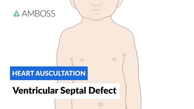Ventricular Septal Defect Murmur