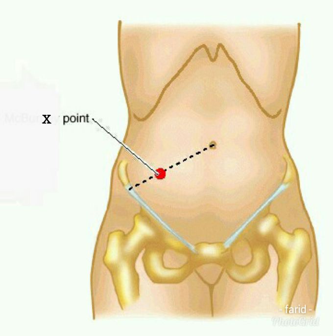 What's the name of x point?!!and what's the using of it??