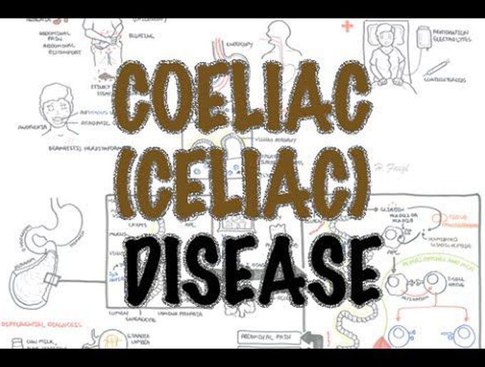 Pathogenesis of Coeliac disease
