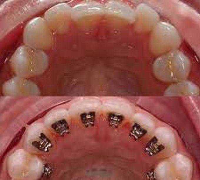 Orthodontics